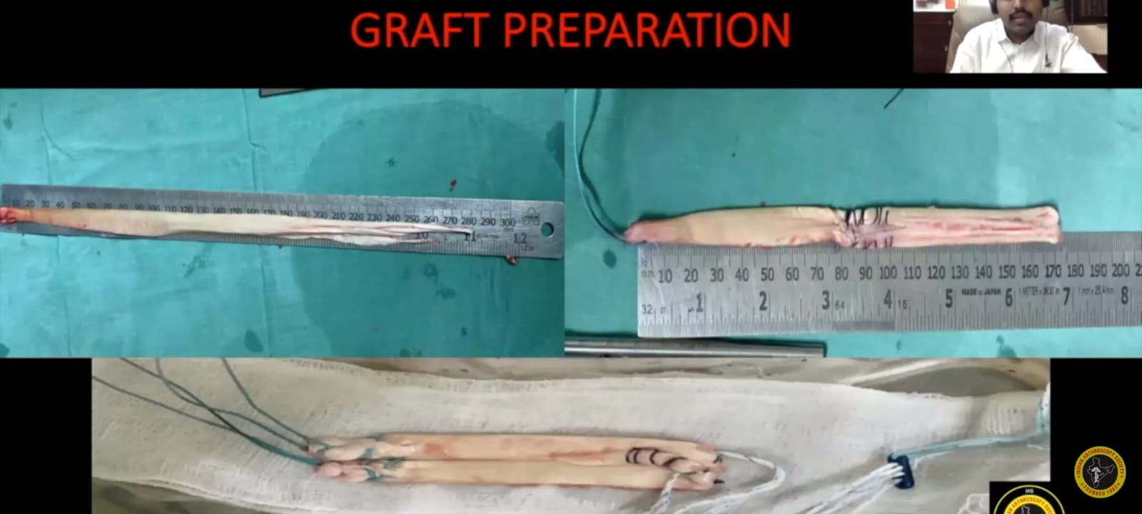 GRAFT PREPARATION 